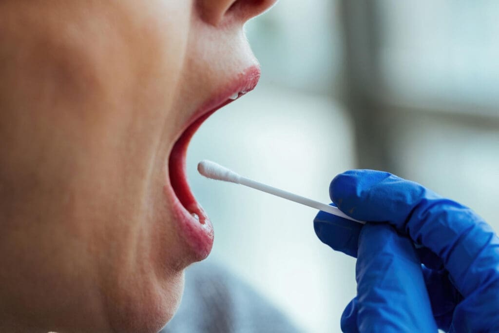 Oral Cancer Screening